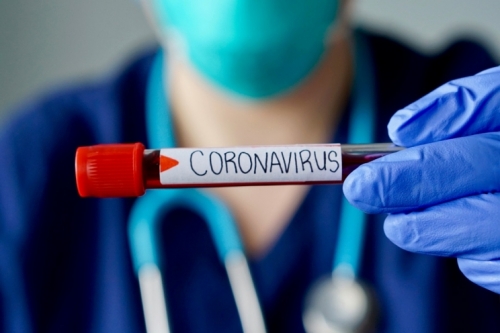 Coronavirus, 10 nuovi casi nelle ultime 24 ore in Calabria. Il bollettino