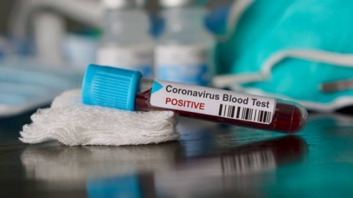 Coronavirus, 643 tamponi in più e 6 nuovi positivi in Calabria. Il bollettino