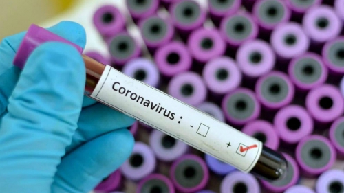 Coronavirus, 1192 tamponi in più e 1 nuovo positivo in Calabria. Il bollettino