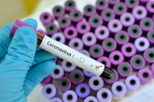 Coronavirus, aumentano i contagi a Sant’Andrea: altri 3 positivi