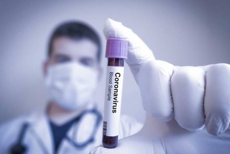 Coronavirus, 426 nuovi positivi in Calabria. Il bollettino