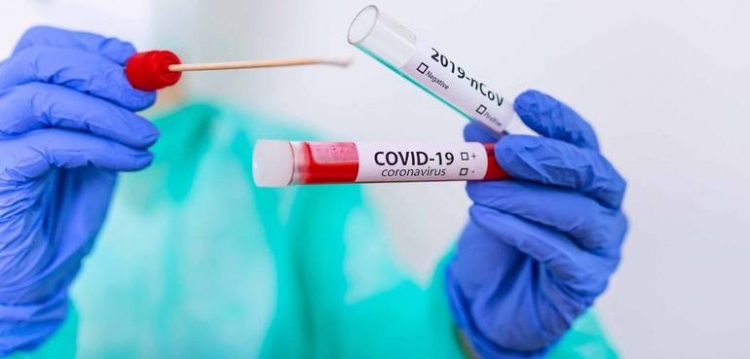 Coronavirus, balzo dei contagi in Calabria: 234 nuovi positivi