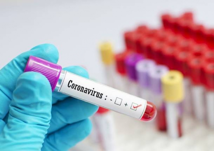 Coronavirus, 207 positivi e 7 nuovi decessi in Calabria. Il bollettino