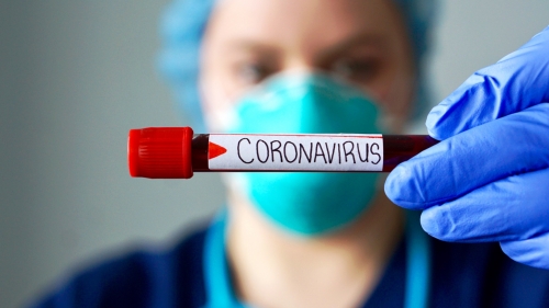 Coronavirus, 158 positivi e 6 morti nelle ultime 24 ore. Il bollettino