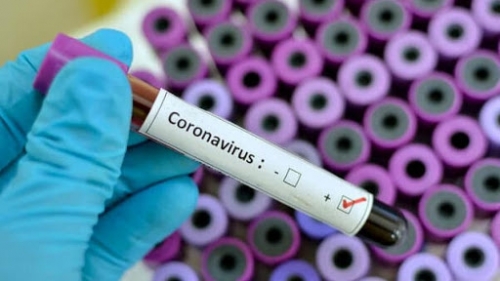 Coronavirus, 232 nuovi positivi e 484 guariti/dimessi in Calabria. Il bollettino