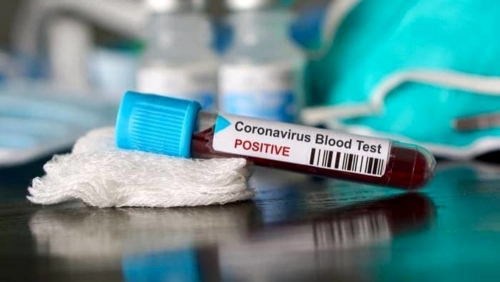 Coronavirus, 340 nuovi positivi in Calabria. Il bollettino